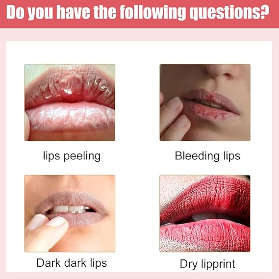 Lips Bleaching Cream Balm